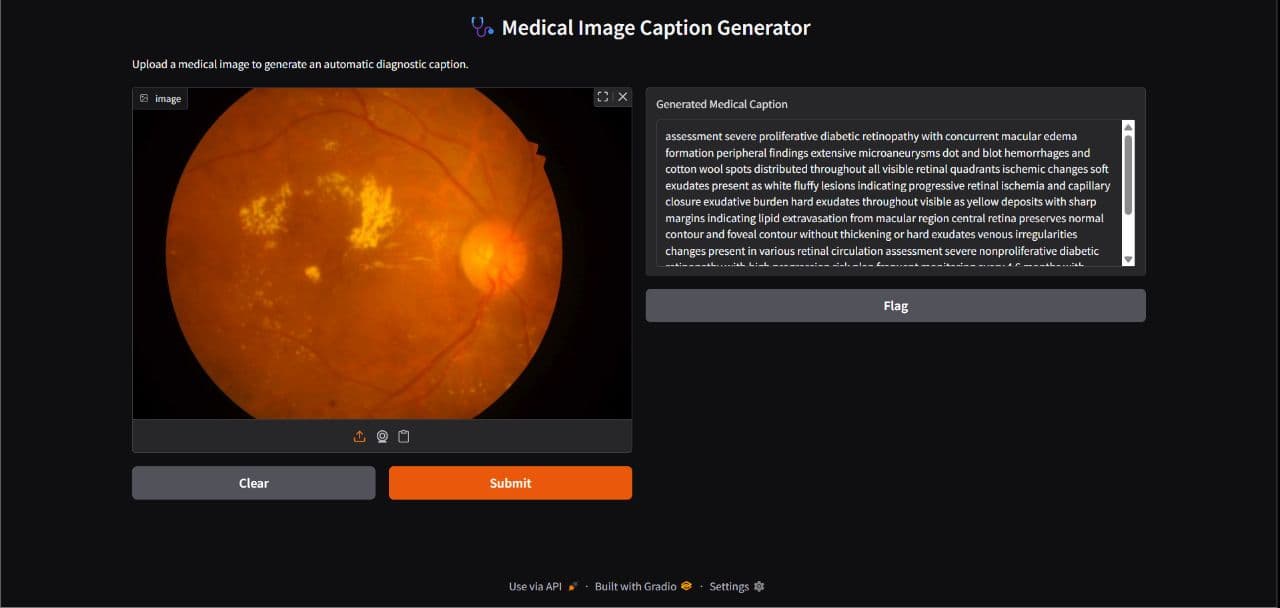 Image Caption Generation - Retinal Disease
